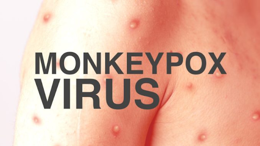 Monkeypox -What Is It?