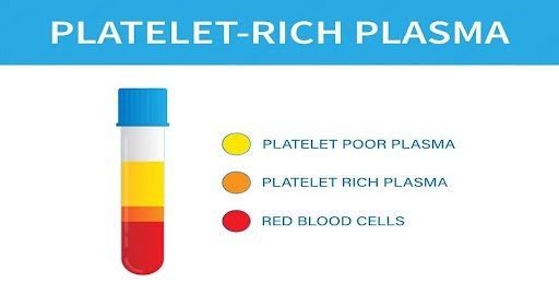 platelet rich plasma