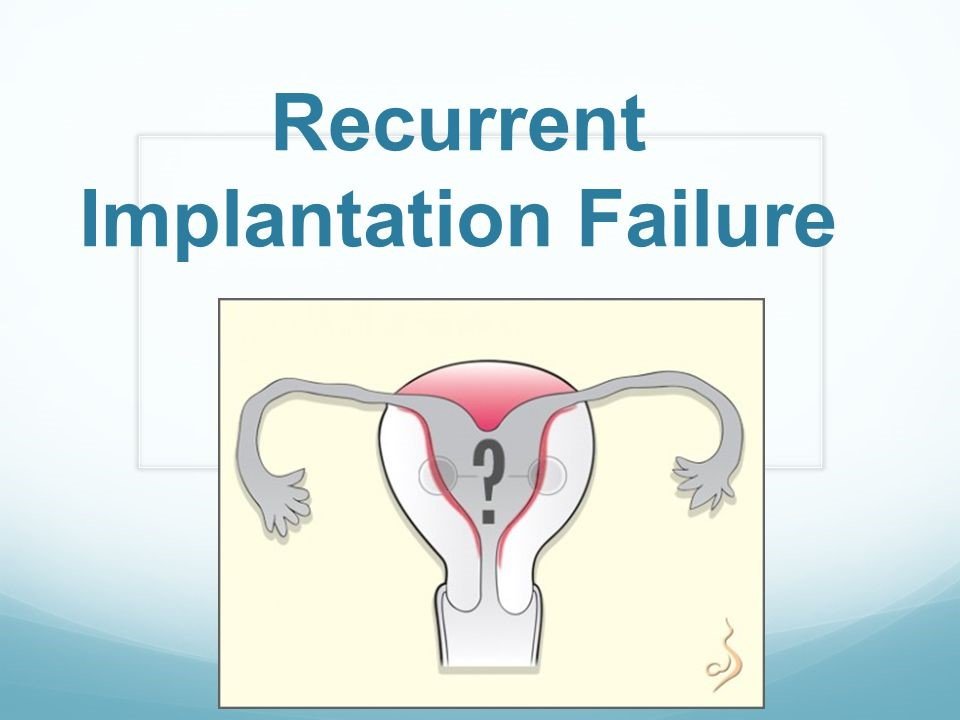 Recurrent Implantation Failure (RIF)