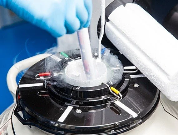 Embryo Freezing