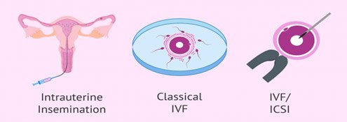 Assisted reproduction techniques