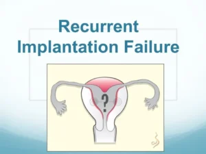 Recurrent Implantation Failure