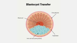 blastocyst transfer