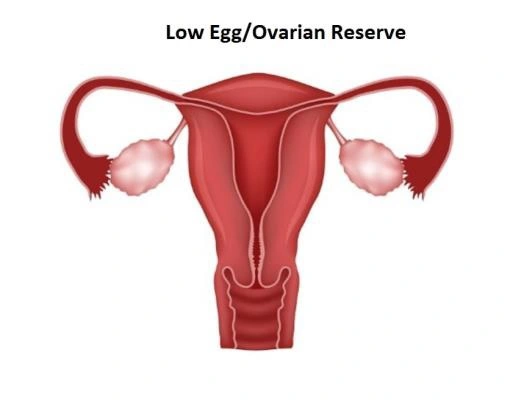 Ovarian Reserve