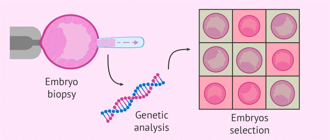 embryo biopsy